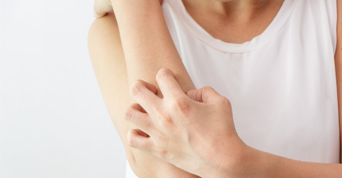 Traitement de la Dermatillomanie - Dr. GOMEZ psychologue Montpellier